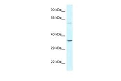 BAG5 Rabbit anti-Human, Polyclonal, Novus Biologicals 0.1ml; Unconjugated:Antibodies,